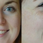 Wrinkles Be Gone!